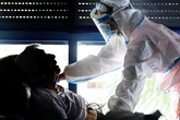 La pandemia de Covid aceleró el envejecimiento del cerebro, incluso sin contagio infeccioso
