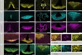 Una técnica fluorescente permite ver por primera vez cómo Mounjaro actúa en el cerebro y controla el apetito