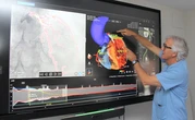 Un 'google maps' coronario para guiar operaciones complejas de corazón