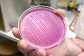 Investigadores de la UCM identifican en bacterias nuevos mecanismos de defensa a terapias alternativas a los antibióticos