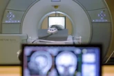 Muere un hombre con un pesado collar metálico de 9 kilos arrastrado por una máquina de resonancia magnética