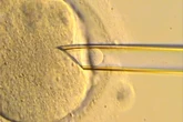 Primeros resultados de bebés nacidos con una tecnología pionera que reduce el riesgo de enfermedades mitocondriales