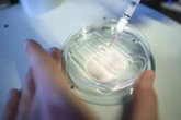 En busca de los genes cromosómicos que dañan el corazón: descubren el gen HMGN1, clave en las cardiopatías del Síndrome de Down