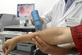 La infección por un virus común mejora la respuesta al tratamiento contra el melanoma