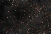 Visualizan por primera vez las huellas tempranas de párkinson en tejido cerebral 'post mortem'