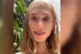 Muere a los 27 años por desnutrición Karolina Kryzak, la influencer que solo comía fruta y pesaba 22 kilos