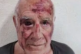 Domingo, el vecino agredido en Torre Pacheco: "Ojalá todo hubiera sido un sueño"