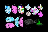 NextBrain, un atlas cerebral que desvela subregiones clave para la detección precoz de enfermedades neurodegenerativas