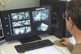Desarrollan el 'software' más avanzado del mundo para estudiar el cerebelo: "No existe nada similar en la actualidad"