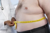 El colágeno, una nueva arma para perder peso y combatir la obesidad
