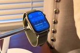 Probamos el Apple Watch Series 11: por fin acaba con uno de sus mayores problemas