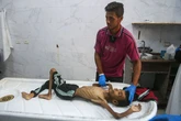 El hambre en Gaza: "He visto niños con brazos más delgados que mis dedos"