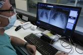 Más de la mitad de las muertes en 2024 fueron causadas por tumores o enfermedades cardiovasculares