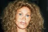 Muere Jocelyn Wildenstein, la 