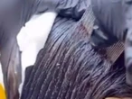 Shock clip of girl with millions of head lice