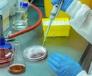 Śmiertelna choroba mózgu u pracownic laboratorium. Badania wstrzymano