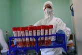 Pochodzenie koronawirusa. Najnowsze badania przerażają. Teraz wszyscy uznają, że wydostał się z laboratorium?