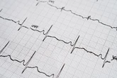 La presión física que ejerce el latido cardiaco podría explicar por qué el corazón está 'blindado' contra el cáncer