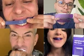 Los dentífricos de TikTok: expertos advierten del peligro de seguir "las modas virales" de productos sin supervisión médica