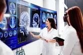 El cerebro, en el centro de la presión sanitaria en España