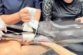 Piden voluntarios para el cuidado de un delfín que fue encontrado herido en una playa de Tailandia