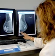 Sanidad aprueba la ampliación del cribado de cáncer de mama a mujeres de entre 45 y 74 años