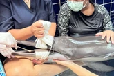 Tailandia busca voluntarios para cuidar a la "pequeña Blancanieves", un delfín hallado herido en una playa