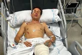 Los médicos descartan una segunda intervención al torero Tomás Angulo, herido "muy grave" en Moralzarzal