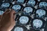 La importancia del criticoma: ventanas de plasticidad en las que "el cerebro absorbe como una esponja toda la información"