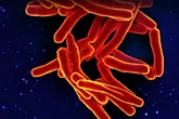 Cinco positivos por tuberculosis en el Instituto de Medicina Legal y Ciencias Forenses de Toledo por graves deficiencias en las instalaciones