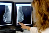 Un 68% de las mujeres de 50 a 69 años declara haberse realizado una mamografía en los últimos dos años, frente al 81,5% en 2017