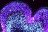 Un mapa celular revela cómo el síndrome de Down altera el desarrollo prenatal del cerebro