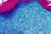 Acusan a dos virólogos en EEUU de intentar entrar en Denver con varios viales del virus de la viruela del mono traídos desde África