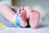 Sanidad amplía la prueba de talón a 21 patologías y el cribado de colon mientras que los 74 años