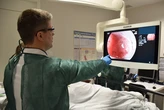 Nuevos test para adelantarse al cáncer de colon