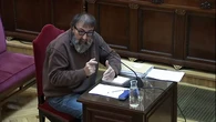 Si no tuviera tres pelos, ya no sería mi Koldo