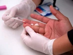 ‘Exceptionally’ virulent variant of HIV discovered in the Netherlands