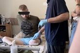 Botox injections could help pain relief for Ukrainian war amputees