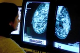 Cancer vaccine being trialled by NHS could herald ‘dawn of a new age’