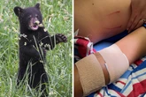 Florida man yells at bears to scare them off—one attacks instead