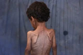 Starving Gazans trade gold for flour as ‘insane’ food prices spiral