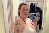 ‘Mounjaro is making my hair fall out – but it’s worth it’