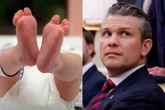 Trump admin halts funding for research on heart defects in babies