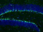 Study could lead to injections replicating brain benefits of exercise
