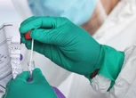 Longest known ‘extreme’ Covid infection seen in 72-year-old man