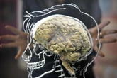 ‘Huge advance’ helps tumour drug reach human brain for first time