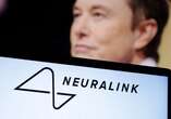 Former Neuralink worker sues company after infected monkey scratch