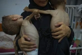 Sick children from Gaza to be evacuated to UK for critical treatment
