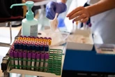Breakthrough blood test detects cancer years before symptoms appear