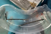 Teen undergoes major surgery after swallowing up to 100 magnets